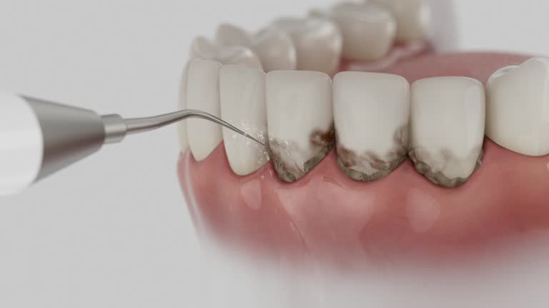 Reliable Teeth Cleaning And Checkup contractor in Blaine County County, ID by Dentist Open Now